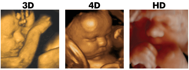 in vitro fertilisation in ahmedabad
